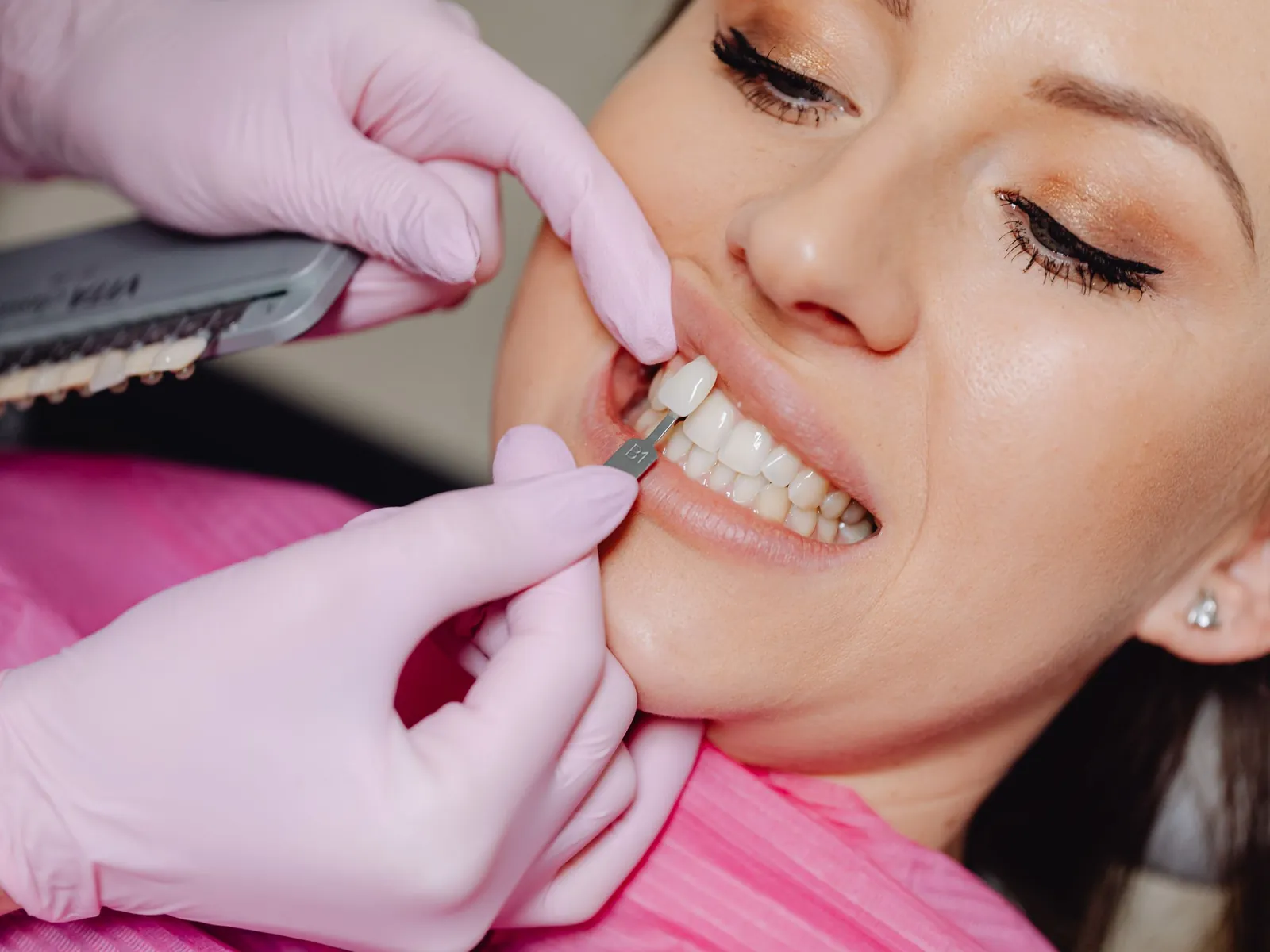A porcelain veneer being tried against a woman&rsquo;s front tooth before it is fitted